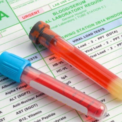 MOBILE BLOOD DRAW